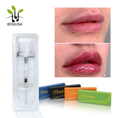Cer genehmigte injizierbare Hyaluronsäure-Hautfüller-Lippenverbesserung