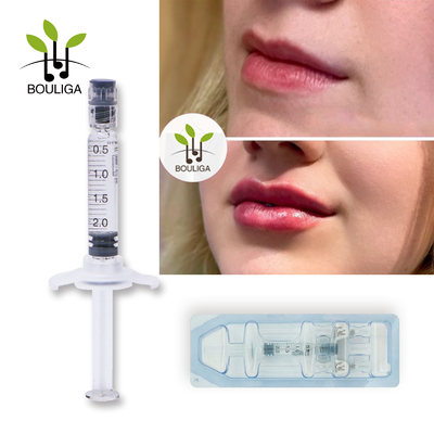 Hautfüller-monophasischer verbundener Hyaluronsäure-Querfüller der Lippen2ml für Lippe