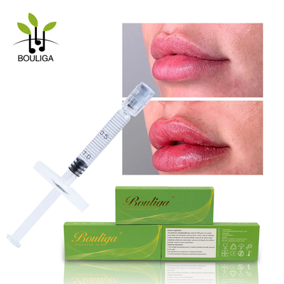Kosmetische querverbundene Hyaluronsäure-Füller-Lippenerweiterung injizierbar
